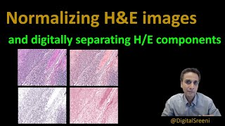 122  Normalizing HampE images and digitally separating Hematoxylin and Eosin components [upl. by Enomor914]