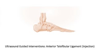 ultrasound Guided Interventions ATFL injection fyp sport sports sportsmedicine [upl. by Ettenaj]