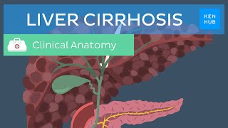 Liver cirrhosis Definition pathology diagnosis treatment and prevention  Kenhub [upl. by Enileuqcaj]