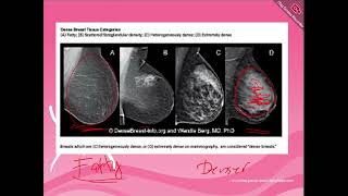 Mammography 1 [upl. by Htims798]