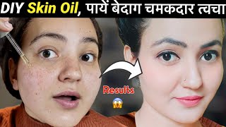 Homemade FACE  SKIN OIL Serum  Get Rid of Acne Pimples Fine Lines Glowing Spotless Skin💕 [upl. by Gizela937]