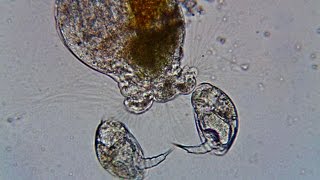 A Collotheca Rotifer Meets Two Colurella Rotifers [upl. by Isnan]