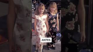 ANTES x DEPOIS gêmeas Olsen [upl. by Frodin]