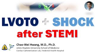 Cardiogenic Shock from LVOT obstruction postMI [upl. by Purington]