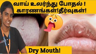 வாய் அடிக்கடி உலர்ந்து போகும் பிரச்சனை காரணங்கள் தீர்வுகள்Dry mouth reasons and solutions in tamil [upl. by Thorbert351]