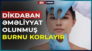 MASKA REJİMİ QAYITDI  CƏRİMƏ 118 MANAT  STV XƏBƏR [upl. by Hashimoto65]