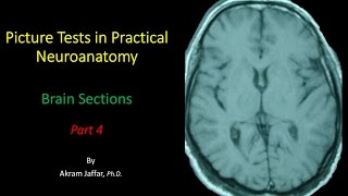 Picture Test in Neuroanatomy Brain Sections 4 [upl. by Eetsirhc812]