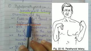 Parathyroid Disorders  Hypoparathyroidism and Hyperparathyroidism [upl. by Hynda]