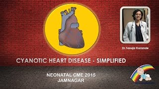 Cyanotic Heart Disease  Simplified By Dr Tanuja Karande [upl. by Howlyn]