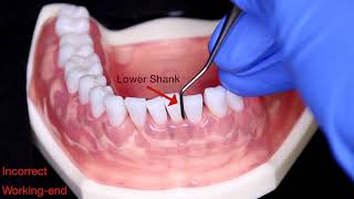 Universal Curet Anterior Technique [upl. by Aserat]