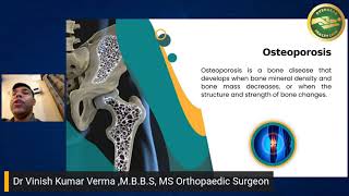 Dr Vinish Kumar Verma MBBS MS Orthopaedic Surgeon [upl. by Nuhs294]