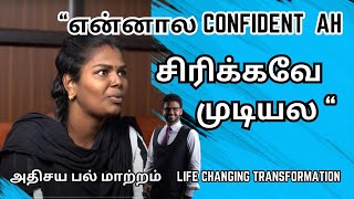 ஒரே நாளில் அதிசய பல் மாற்றம் 𝐓𝐄𝐄𝐓𝐇 𝐈𝐍 𝐀 𝐃𝐀𝐘🅵🆄🅻🅻 🆂🅼🅸🅻🅴 🆃🆁🅰🅽🆂🅵🅾🆁🅼🅰🆃🅸🅾🅽 🅸🅽 🆃🅰🅼🅸🅻 [upl. by Ilke747]