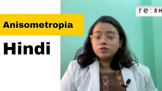 Anisometropia  Anisometropic Amblyopia  Hindi [upl. by Darrin]