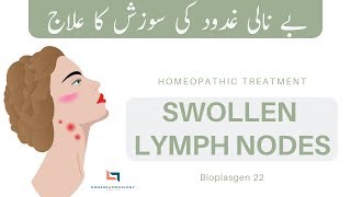 Swollen Lymph Nodes in Neck Homeopathic Treatment  SCROFULA ENLARGED GLANDS  Bioplasgen 22 [upl. by Sofie167]