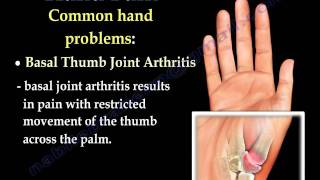 Hand Pain Fingers pain  Everything You Need To Know  Dr Nabil Ebraheim [upl. by Aivizt]