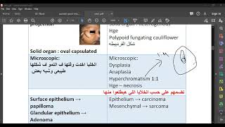 L25 Pathology Salivary Gland Tumors 1 [upl. by Dario652]