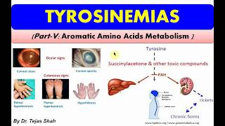 Tyrosinemias II Inborn errors of Aromatic Amino Acids Metabolism II Biochemistry II Dr Tejas Shah [upl. by Nylsej]