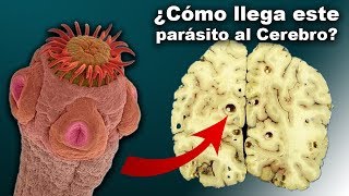 Cómo Llega este Gusano al Cerebro  con Centro Selenium [upl. by Darn]