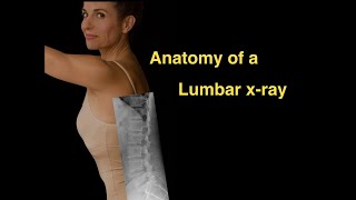 Anatomy of a Lumbar xray [upl. by Neelrad]