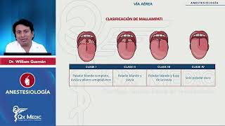 ANESTESIOLOGÍA Vía aérea Test de Mallampati mp4 [upl. by Tlihcox]
