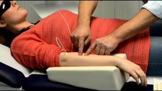 Treating an epicondylitis by laser needle acupuncture with the Weberneedle ® Compact Laser [upl. by Lladnor]