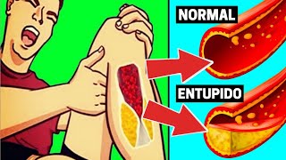 CUIDADO 6 SINAIS DE QUE SUAS ARTÉRIAS ESTÃO ENTUPIDAS [upl. by Krissy]