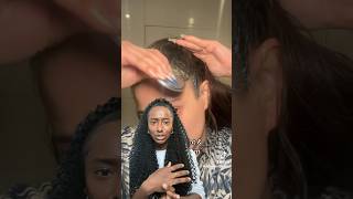 Scalp PsoriasisScalp Eczema [upl. by Moor]