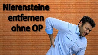 Nierensteine Entfernen ohne OP  so geht das [upl. by Eatnhoj659]