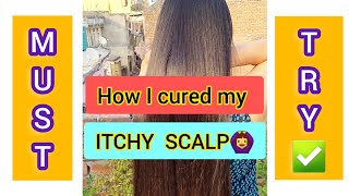 Scalp itching home remedy  Scalp itching treatment [upl. by Yekcim585]