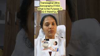 TRANSVAGINAL Sonography IS IT PAINFUL PURPOSE [upl. by Adlog]