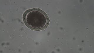 Toxocara canis vs Giardia size comparison [upl. by Seabrooke]