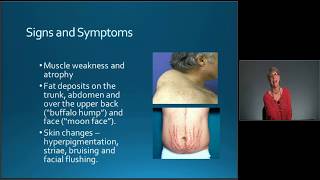 MedicalSurgical Nursing Exam Review Endocrine Disorders  MEDED [upl. by Wahlstrom459]