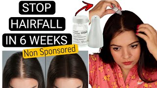 HOW I STOPPED MY HAIRFALL IN 6 WEEKS  LOREAL AMINEXIL HAIR SERUM REVIEW  HAIRFALL TREATMENT [upl. by Beaston]