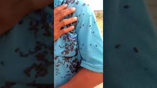 Lots of lice on his bodyshortvideo trending viral [upl. by Ellak]