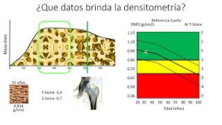 Densitometría e imagenes salud ósea en el climaterio [upl. by Rama]