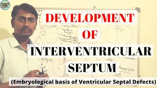 DEVELOPMENT OF INTERVENTRICULAR SEPTUM  VSD [upl. by Ahsotan]