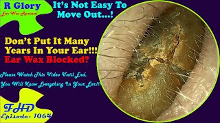 Why Your Ear Not Hear Anything  New Video Ear Wax Removal 1064 [upl. by Nodal]