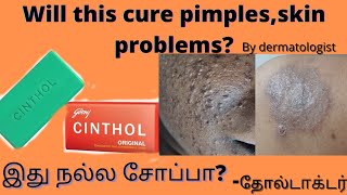 originalold cinthol soap review by dermatologistwill it cure pimples skin problems [upl. by Eintrok]