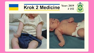 Krok 2 Medicine  Year 2019  152 Ministry of Public Health of Ukraine [upl. by Aredna]