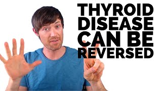 7 Reversible Causes of Hypothyroidism [upl. by Grogan247]