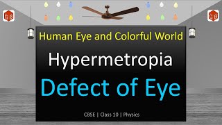 CBSE Board  Hypermetropia Defect of Eye  Human Eye and Colorful World  Class10 Physics cbse [upl. by Jael747]