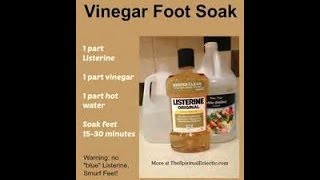 RESULTS Does Soaking Your Feet In Listerine amp Vinegar Make Them Extra Soft [upl. by Yesnek]