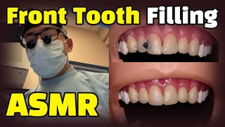 How to fix cavities between front teeth  Dental ASMR Composite Resin Filling Procedure Explained [upl. by Lerual]