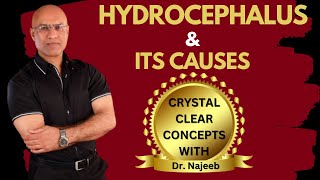 Causes of Hydrocephalus  What is going on in the brain  Dr Najeeb [upl. by Sacrod]