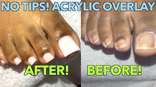 WHITE TOES ACRYLIC TOE NAILS NO TIPS ACRYLIC OVERLAY ON TOES [upl. by Shaikh704]