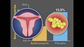 PostCesarean Infection and Antibiotic Prophylaxis  NEJM [upl. by Ahsinrev588]