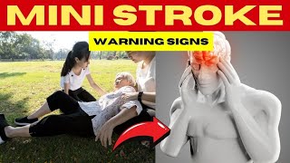 Warning 8 Signs of Mini Strokes [upl. by Hnahym]