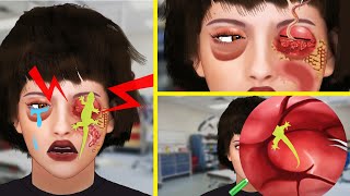 💟 ASMR ☮️ LIZARD Eye Infection SATISFYING Treatment Animation [upl. by Asiuol]