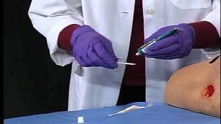 3M™ Tegaderm™ Hydrogel Wound Filler  Application and Removal [upl. by Gnel]