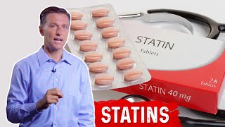 Statins Side Effects amp Alternative Ways to Lower Cholesterol by DrBerg [upl. by Swane]